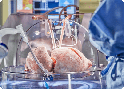 EVLP creates an environment for gathering data from potentially transplantable lungs